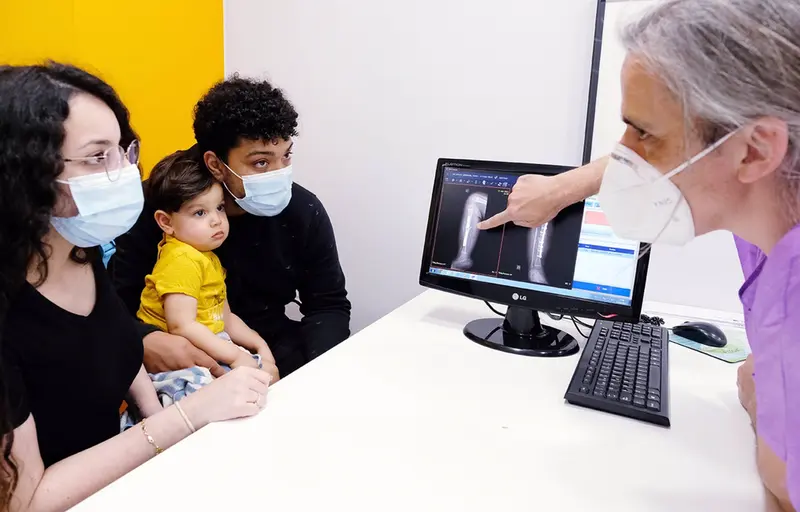  Un beb&eacute; de 23 meses salva su pierna derecha afectada por una malformaci&oacute;n de la tibia con un autotrasplante - HM HOSPITALES 