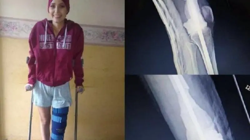  La joven madrile&ntilde;a pide ayuda lanzando un crowfunding - YOSMELY LEAL ZAMBRANO
Obtenido de EuropaPress 