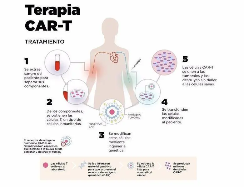  Infograf&iacute;a sobre el funcionamiento de las CAR-T - CL&Iacute;NICA UNIVERSIDAD DE NAVARRA 