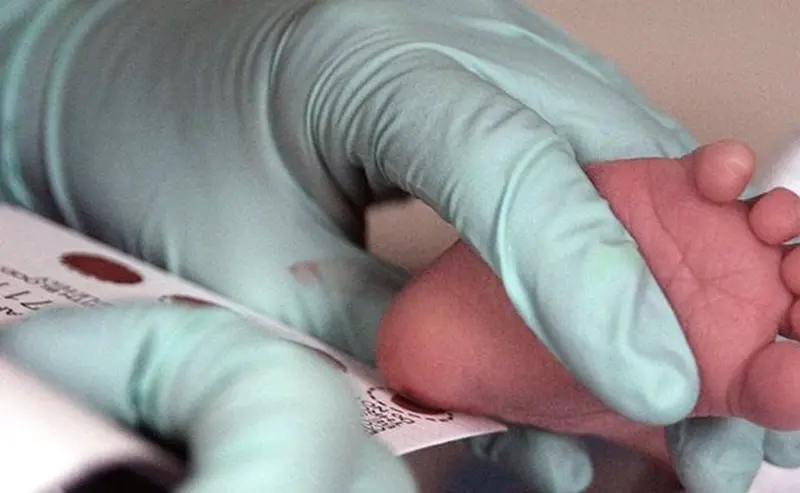  Archivo - Pie de reci&eacute;n nacido - US GOVERNMENT - Archivo 