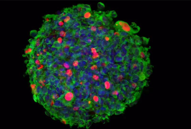 <p> Imagen 3D de inmuno-microscop&iacute;a confocal de una neuroesfera originada por c&eacute;lulas madre aisladas de un paciente de glioblastoma (GSC), e infectadas por el parvovirus Minute Virus of Mice (MVM). - CBMSO, UAM, CSIC </p>