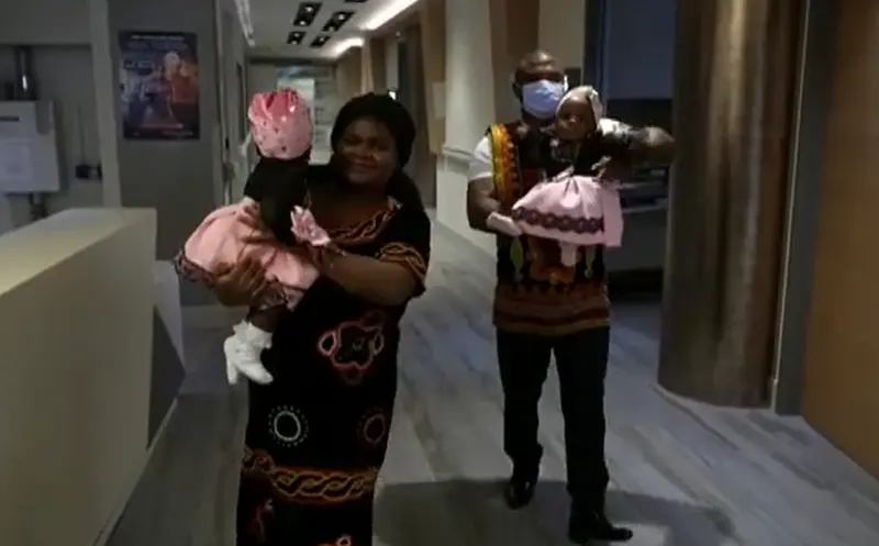 <p> Las gemelas tras la larga operaci&oacute;n. Fuente: Atlas </p>