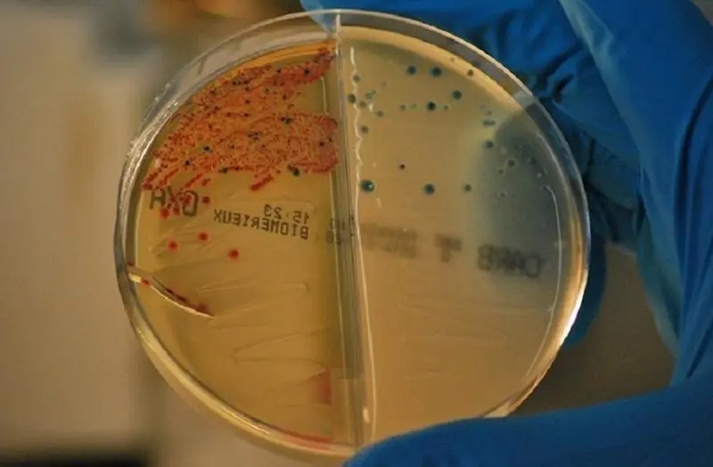 <p> Esta campa&ntilde;a ya ha usado el mismo eslogan otros a&ntilde;os, buscando siempre fomentar el uso responsable. </p>