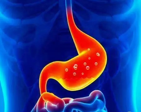 <p> ardor estomacal </p>