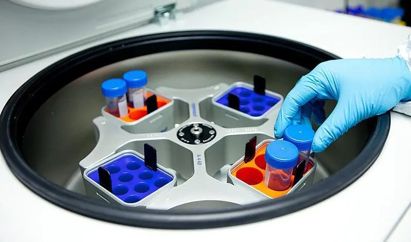 <p> Muestras donadas por pacientes con c&aacute;ncer para investigaci&oacute;n oncol&oacute;gica.- Junta de Andaluc&iacute;a </p>