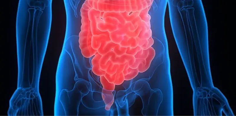 <p> Archivo - Intestino y colon - DONALD WEITZ/FLICKER - Archivo </p>