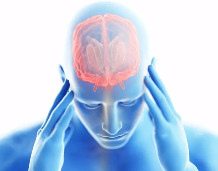 <p> Encefalitis. - HOSPITAL LA LUZ </p>