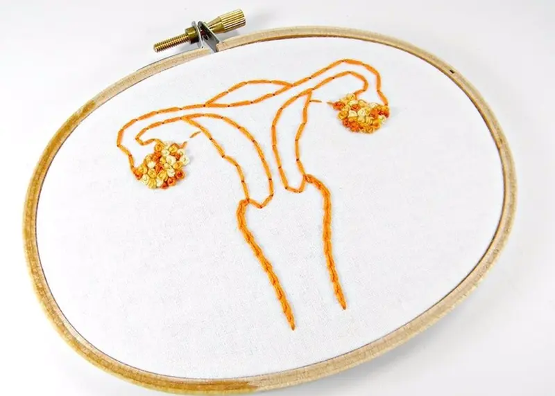 <p> Archivo - &oacute;rgano reproductos femenino. &Uacute;tero, ovarios - FLIICKR/HEY PAUL STUDIOS - Archivo </p>