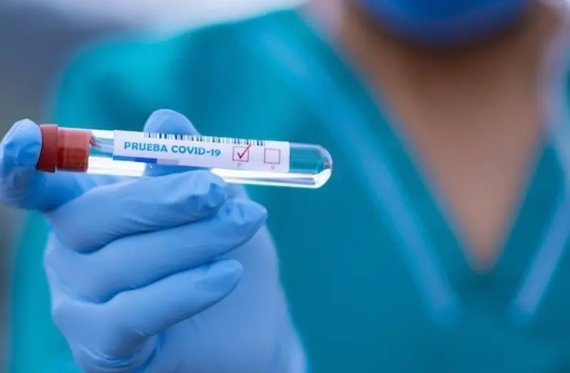 <p> Archivo - Aunando ventajas de la PCR y de los test r&aacute;pidos, RAP-ID19 pretende aumentar la fiabilidad de los diagn&oacute;sticos de COVID-19. / - FERNANDO ZHIMINAICELA/UCC-UCM - Archivo </p>