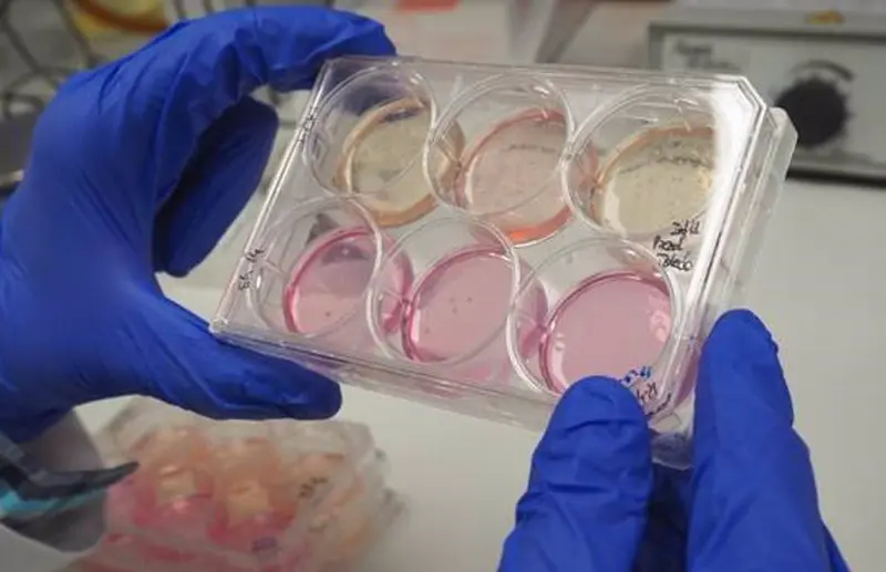 <p> Archivo - Pocillos con c&eacute;lulas tumorales - GEMA DE LA ASUNCI&Oacute;N / CSIC COMUNICACI&Oacute;N - Archivo </p>