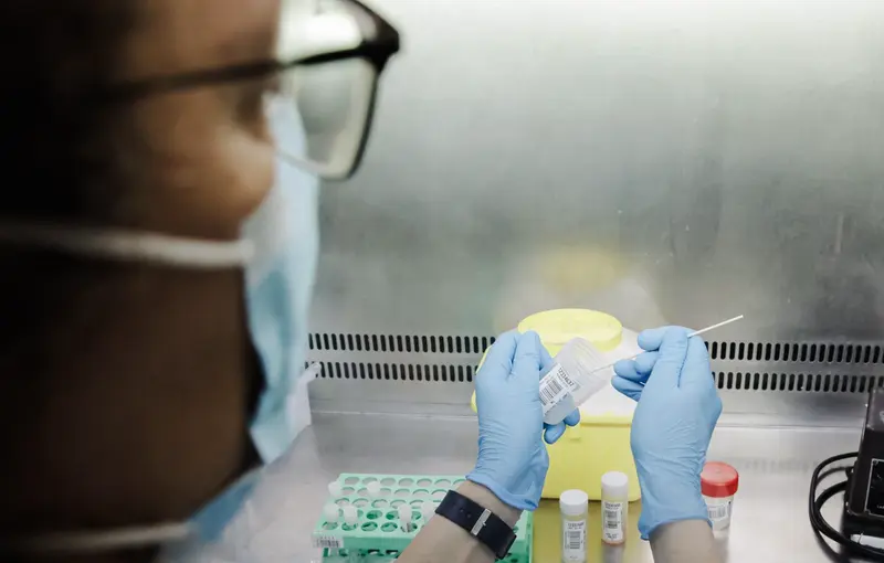 <p> Una t&eacute;cnico de laboratorio sostiene una de las pruebas de an&aacute;lisis para la viruela del mono, en el Hospital Ram&oacute;n y Cajal, a 30 de mayo de 2022, en Madrid (Espa&ntilde;a). La Comunidad de Madrid empieza hoy a realizar en cinco hospitales p&uacute;blicos de la regi&oacute;n la - Carlos Luj&aacute;n - Europa Press </p>