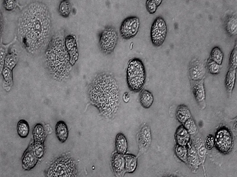 <p> Archivo - Un equipo de la Red de Investigaci&oacute;n en Enfermedades Tropicales (RICET), perteneciente al Instituto de Salud Carlos III, ha descubierto nuevos indicadores sobre c&oacute;mo se ven afectados los tejidos por la enfermedad de Chagas en sus primeras fa - RED DE INVESTIGACI&Oacute;N EN ENFERMEDADES TROPICALES </p>