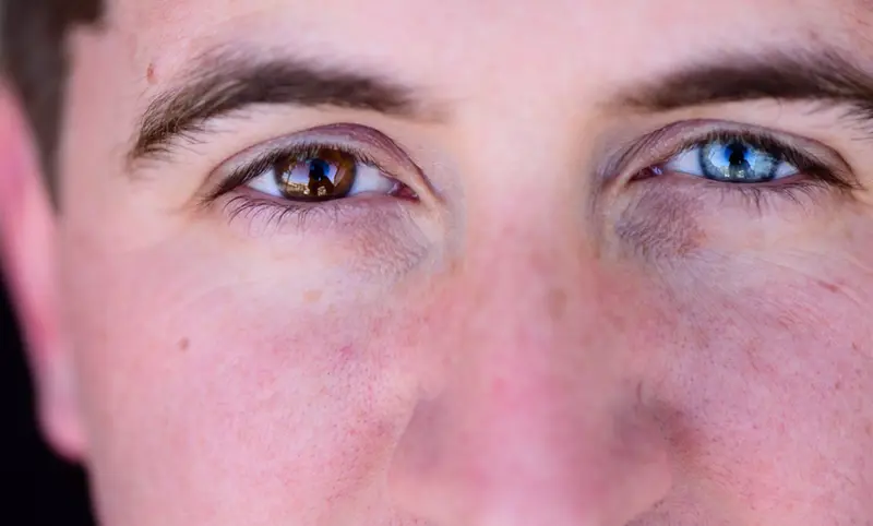 <p> Archivo - Heterocrom&iacute;a. Ojos de distinto color. - WHITNEYLEWISPHOTOGRAPHY/ISTOCK - Archivo </p>