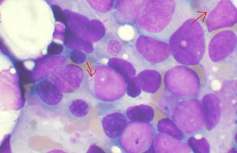 <p> Archivo - Cient&iacute;ficos del Instituto Wellcome Sanger y el Instituto Europeo de Bioinform&aacute;tica (EMBL-EBI), junto a investigadores del Centro de Investigaci&oacute;n Biom&eacute;dica en Red de Epidemiolog&iacute;a y Salud P&uacute;blica (CIBERESP) y de otros centros de relevancia inter - CIBER - Archivo </p>