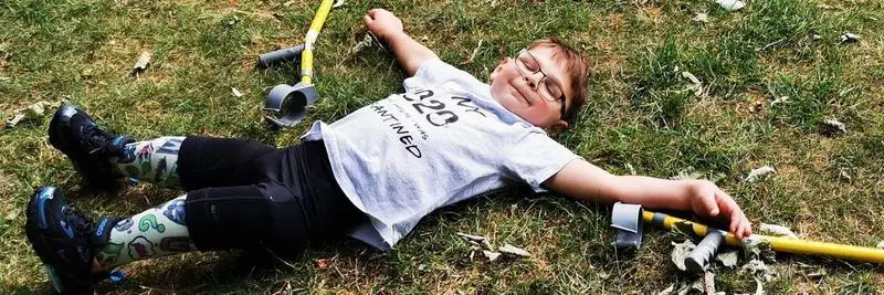 <p> Tony, ni&ntilde;o al que tuvieron que amputar ambas piernas </p>