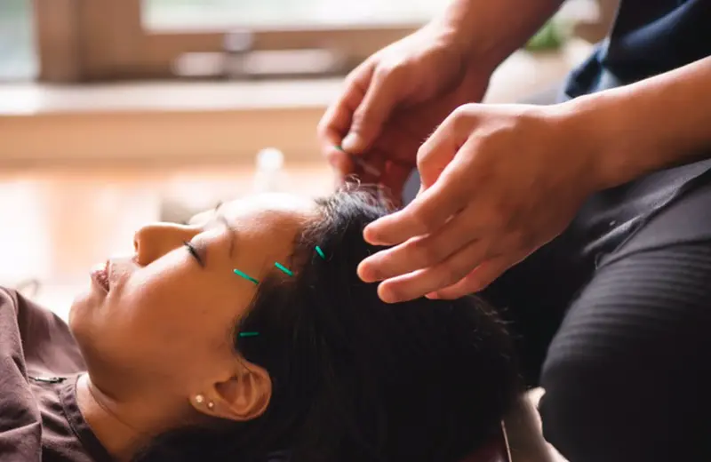 <p> Archivo - Acupuntura - HELOVI/ ISTOCK - Archivo </p>