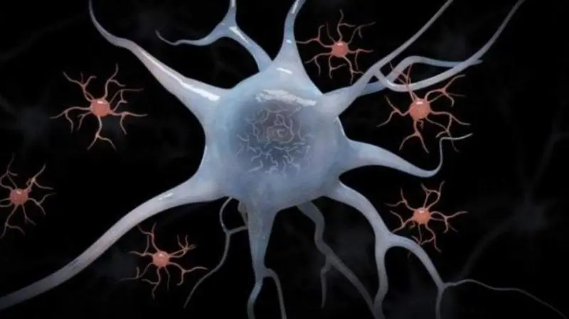 <p> Neuronas. EP </p>