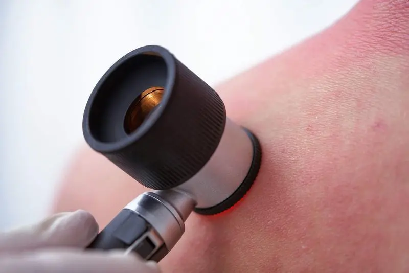 <p> Dermatitis. </p>