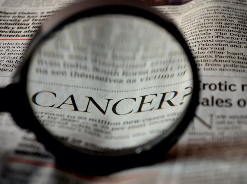  Archivo - El proyecto OPTIMA busca mejorar el tratamiento para el c&aacute;ncer de pr&oacute;stata, mama y pulm&oacute;n aplicando tecnolog&iacute;as de vanguardia - GMV - Archivo 