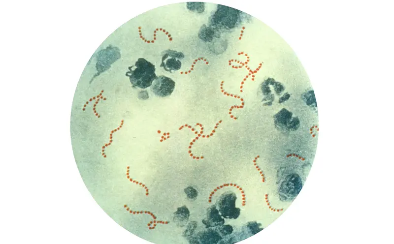 Archivo - La bacteria 'Streptococcus pyogenes', conocida en espa&ntilde;ol como estreptococo - PUBLIC HEALTH IMAGE LIBRARY - Archivo 