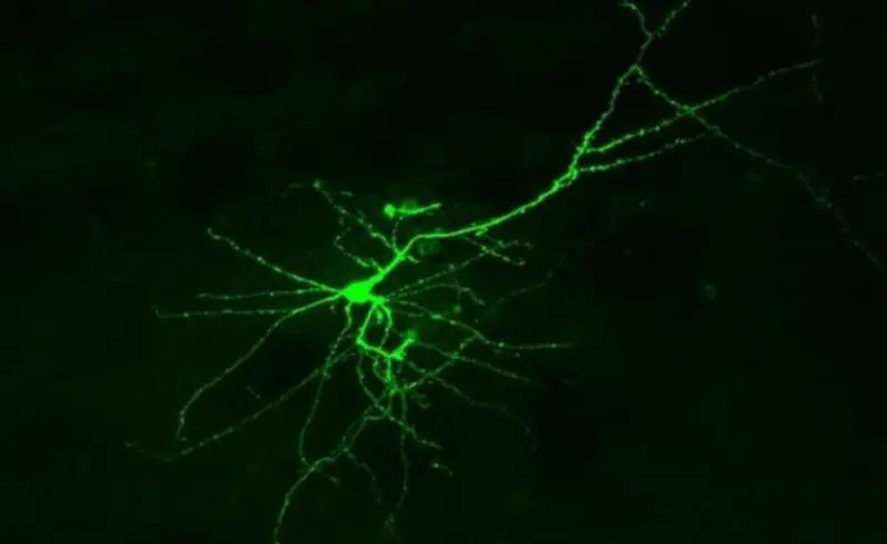  Archivo - Una neurona cultivada vista bajo un microscopio de fluorescencia. - ASTON UNIVERSITY - Archivo 