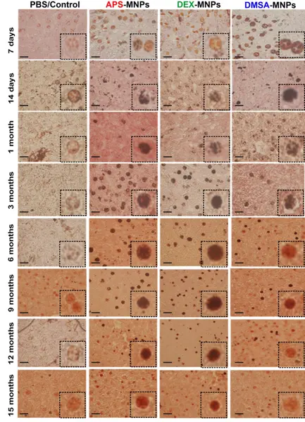  Investigadores del CSIC descubren c&oacute;mo los recubrimientos de las nanopart&iacute;culas afectan a su biodistribuci&oacute;n y degradaci&oacute;n. - UNIVERSIDAD DE ZARAGOZA 