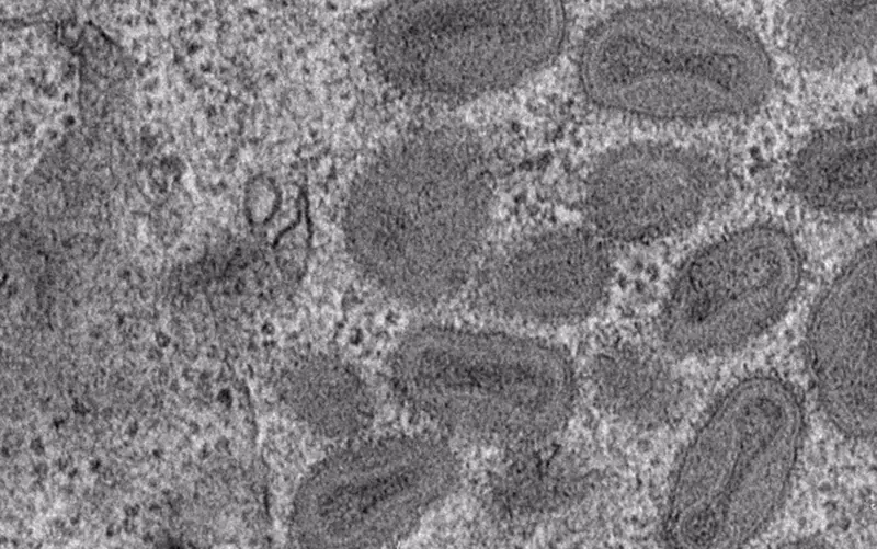  Imagen al microscopio de part&iacute;culas de poxvirus en el interior celular. - INIA-CSIC 
