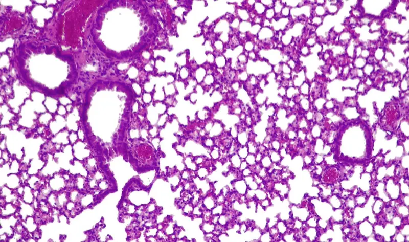  Pulmones de rat&oacute;n con 'pildora viva' activa combatiendo 'presudomonas aerugionosa' - CGR/PULMOBIOTICS 