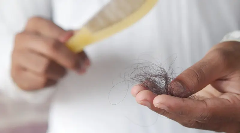  Foto de ca&iacute;da de pelo. Pexels 