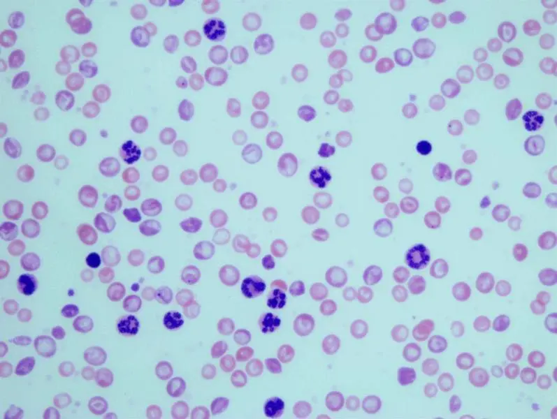  Granulocitos en muestras sangu&iacute;neas de ratones con leucemia mielog&eacute;nica cr&oacute;nica 