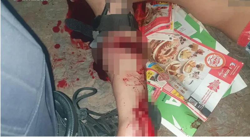  Polic&iacute;a Nacional auxilia al hombre que se estaba desangrando 