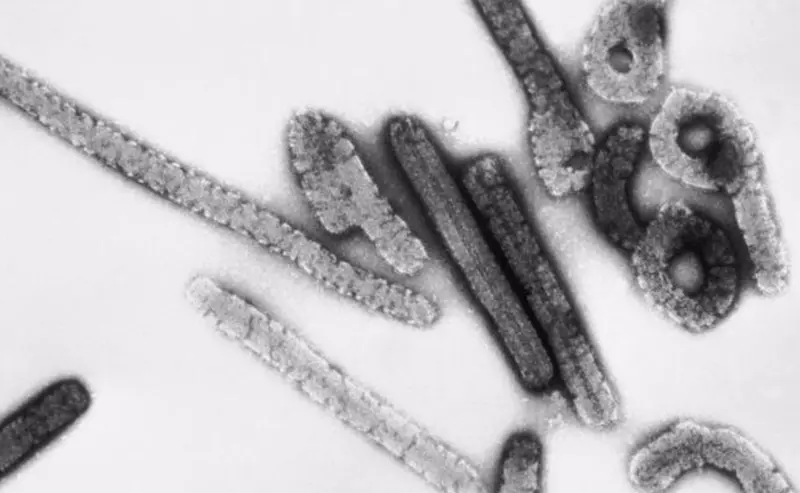  Archivo - Virus de Marburgo. - CDC - Archivo 
