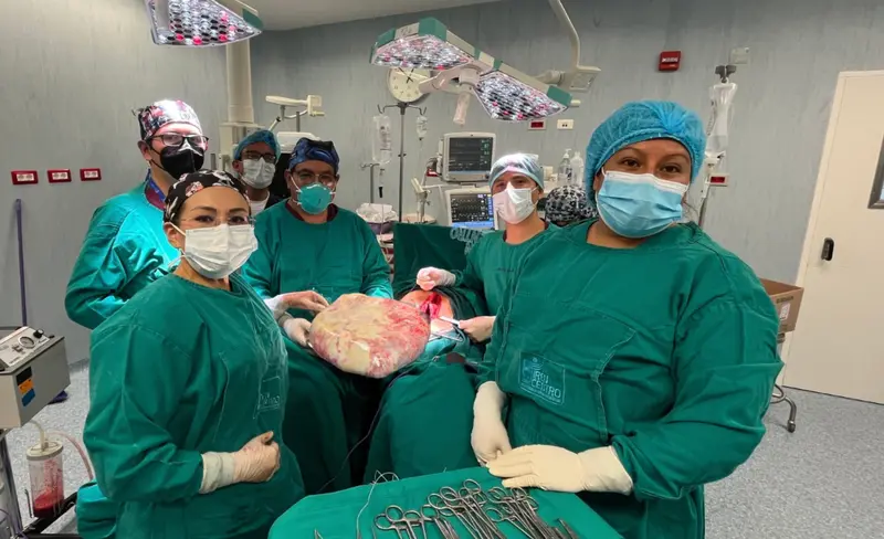  Profesionales junto al tumor extirpado 