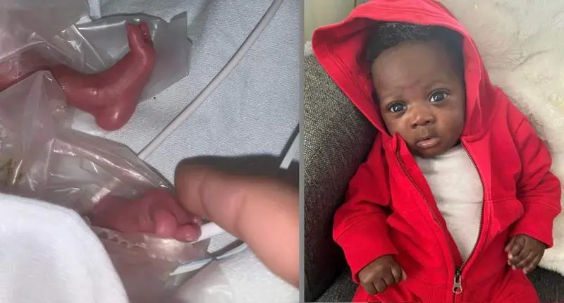  El peque&ntilde;o Kayden al nacer y ahora que ha pasado un mes 