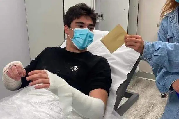 Lance Stroll tras sufrir el accidente de bicicleta 