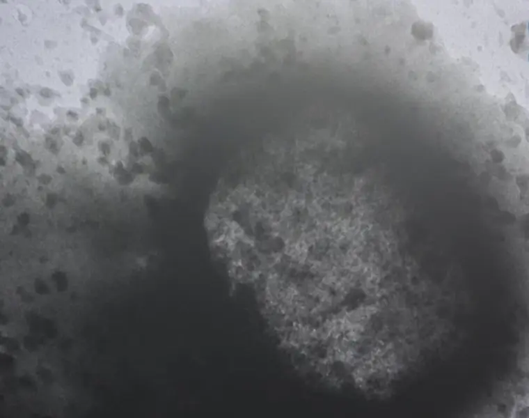  Archivo - Una mol&eacute;cula de la viruela del mono como resultado de un estudio de la universidad Carlos III durante la rueda de prensa posterior al Consejo Interterritorial del SNS, a 25 de mayo de 2022, en Madrid (Espa&ntilde;a). - Jes&uacute;s Hell&iacute;n - Europa Press - Archivo 