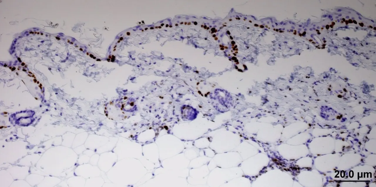  Archivo - Investigadores del CNIO descubren una de las estrategias del c&aacute;ncer para escapar de la quimioterapia. - CNIO - Archivo 