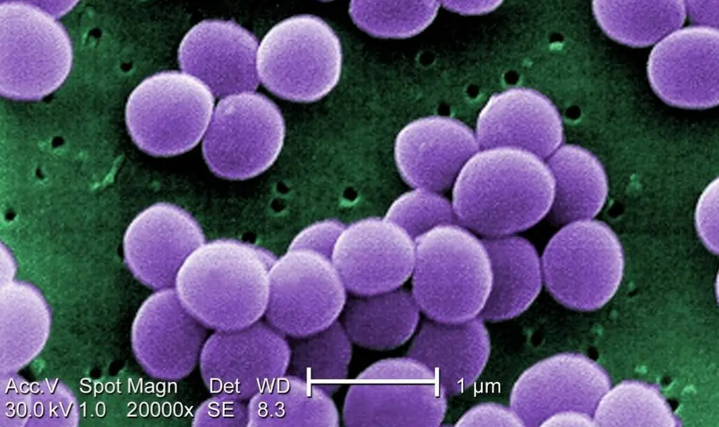  VRSA under a microscope 