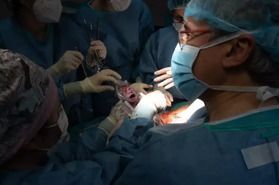  Momento del nacimiento de Jes&uacute;s, por ces&aacute;rea, en el Cl&iacute;nic | Francisco Avia 