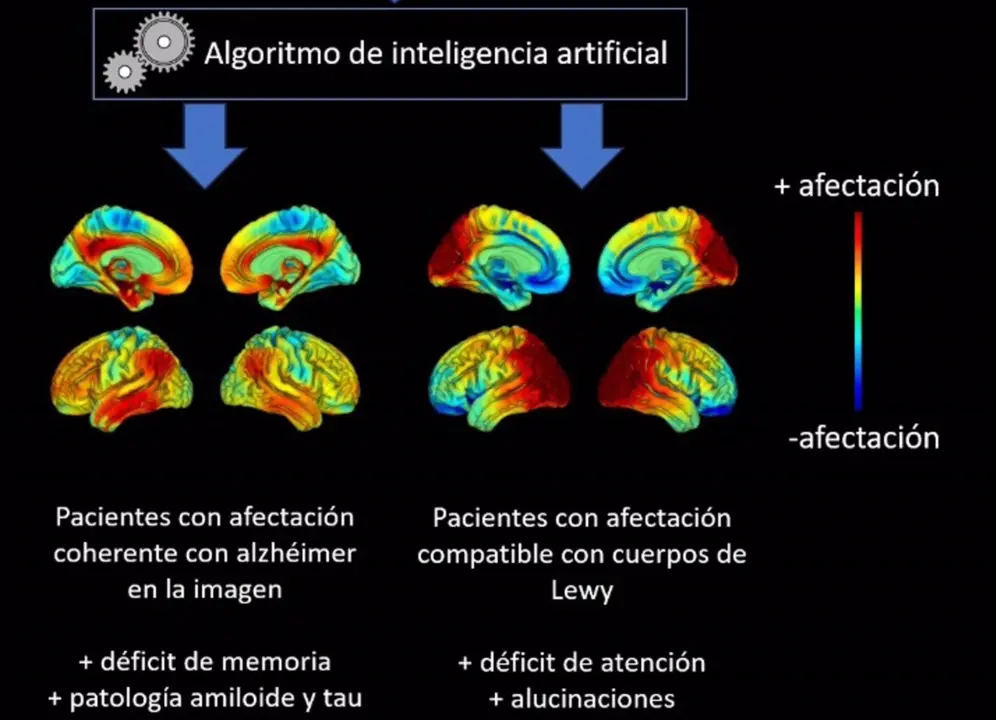  Infograf&iacute;a ilustrativa sobre las t&eacute;cnicas de imagen m&eacute;dica. - IBIS 