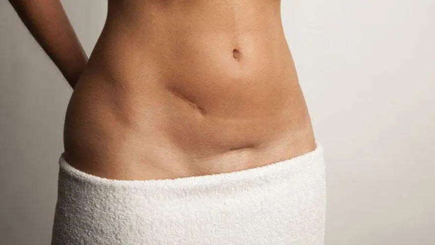  Paciente extirpada de sus ovarios 