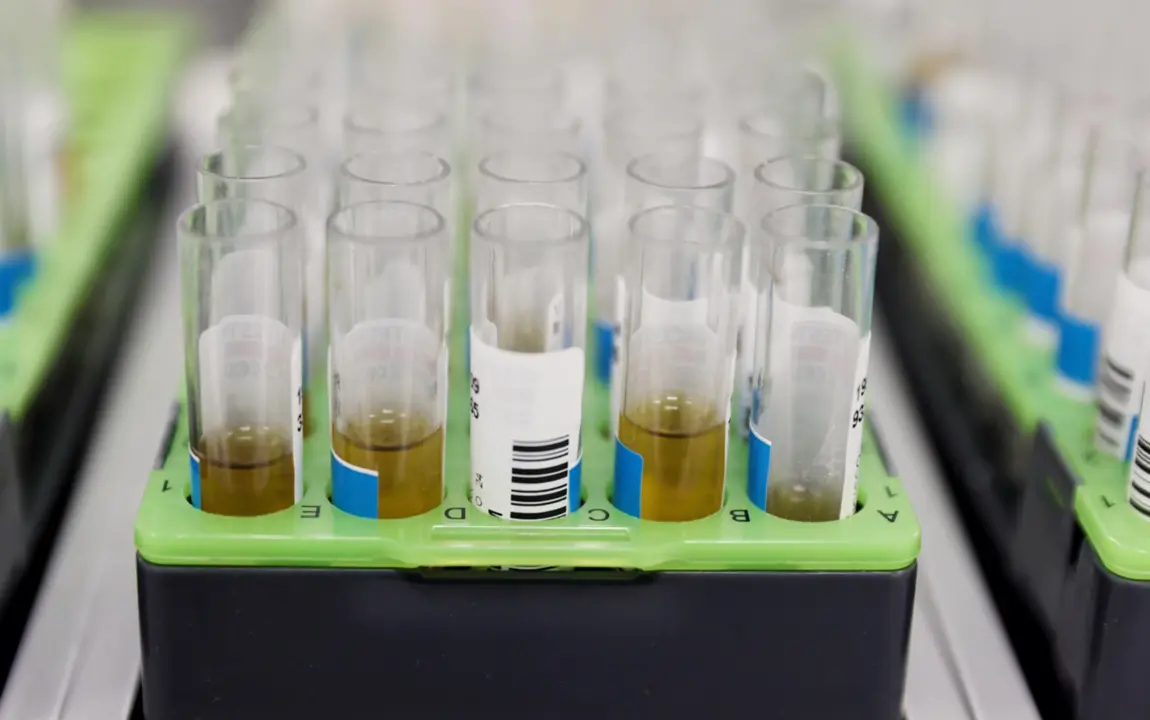  Archivo - Probetas de pruebas para el diagn&oacute;stico de la viruela del mono - Eduardo Parra - Europa Press - Archivo 