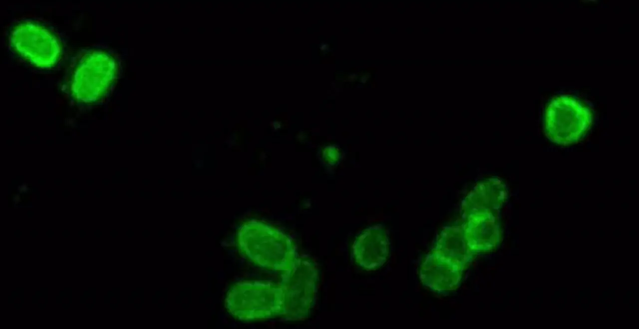  &lsquo;Salmonella Enterica&rsquo; . - CSIC 