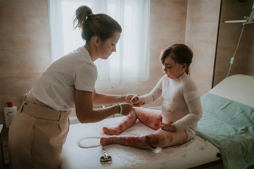  Elena Mart&iacute;n Corradini y su peque&ntilde;a con piel de mariposa 