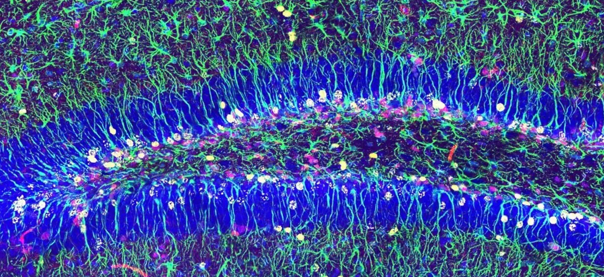  Imagen de microscop&iacute;a confocal mostrando las c&eacute;lulas madre neurales del hipocampo 