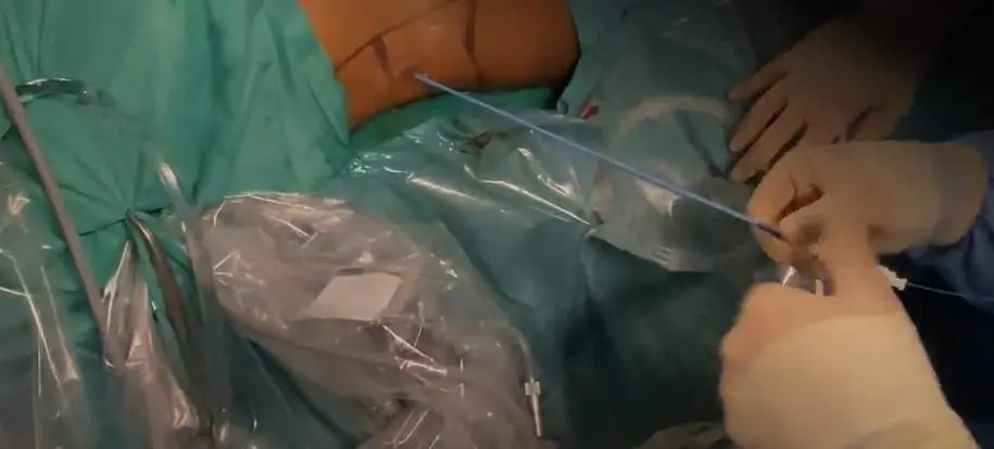  Captura del v&iacute;deo de la intervenci&oacute;n 