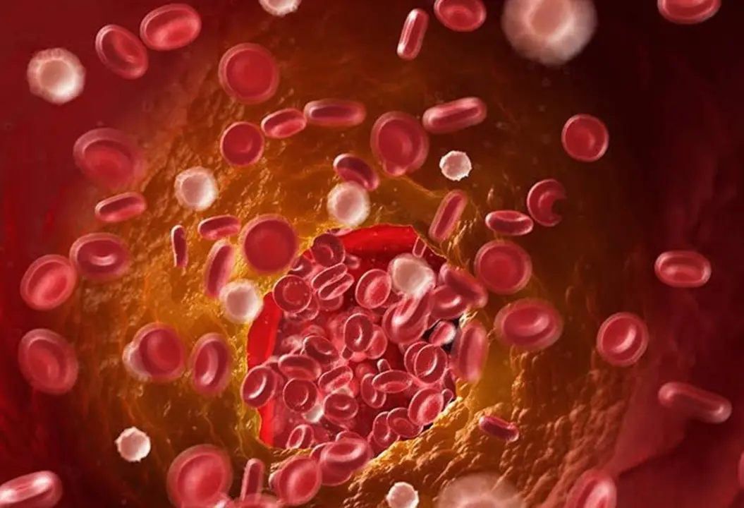  Archivo - Sangre. - UNIVERSIDAD POLIT&Eacute;CNICA DE MADRID - Archivo 