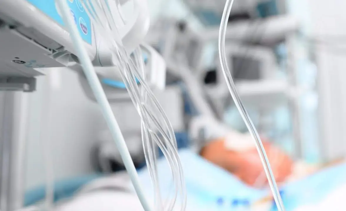  Archivo - UVI, UCI, cuidados intensivos, paciente intubado - ATS - Archivo 