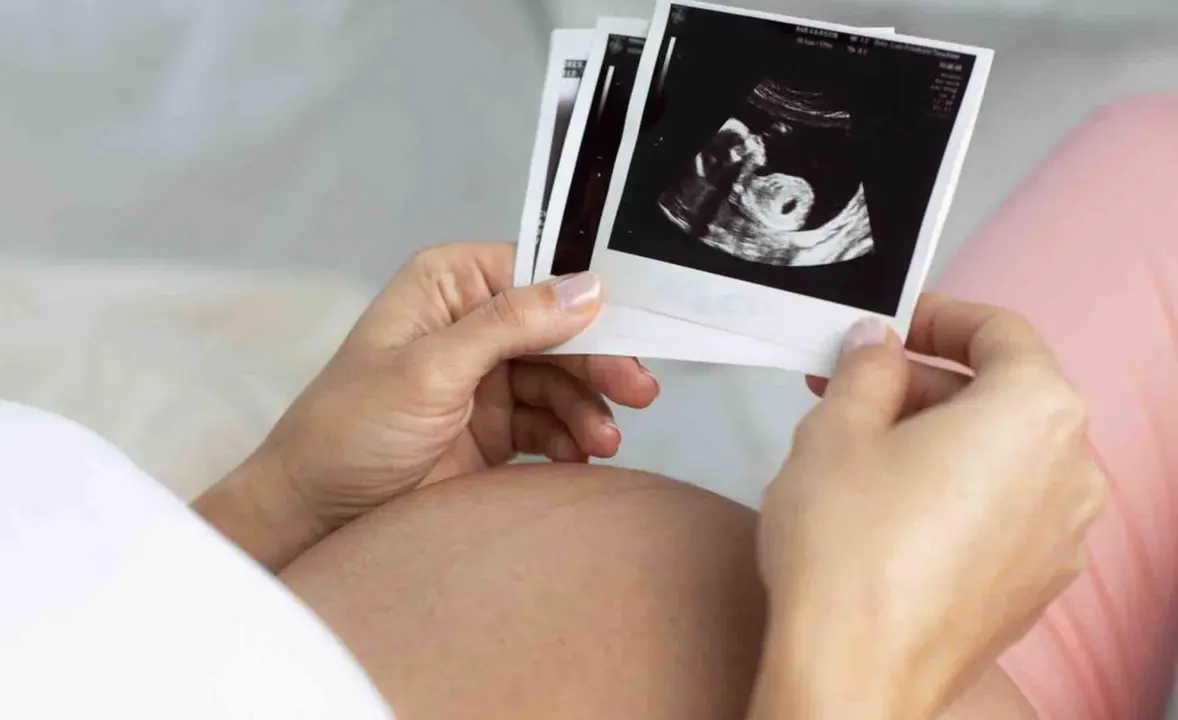  Archivo - Embarazo - CL&Iacute;NICA MARGEN - Archivo 