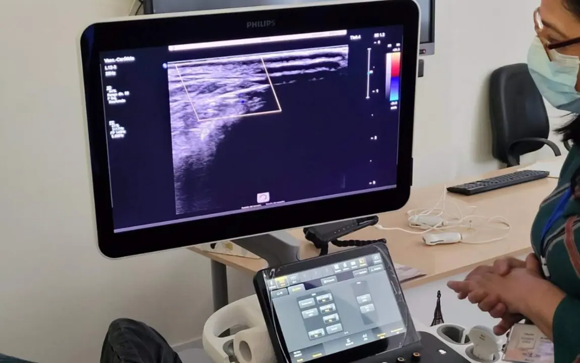  Archivo - Ec&oacute;grafo. - SEMI - Archivo 